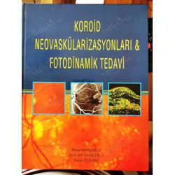 Koroid Neovaskülarizasyonları & Fotodinamik Tedavi Ciltli Koroid Neovaskülarizasyonları & Fotodinamik Tedavi Ciltli
